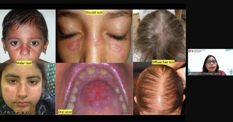 Popmama.com/Anggia Ramadhani Fitri